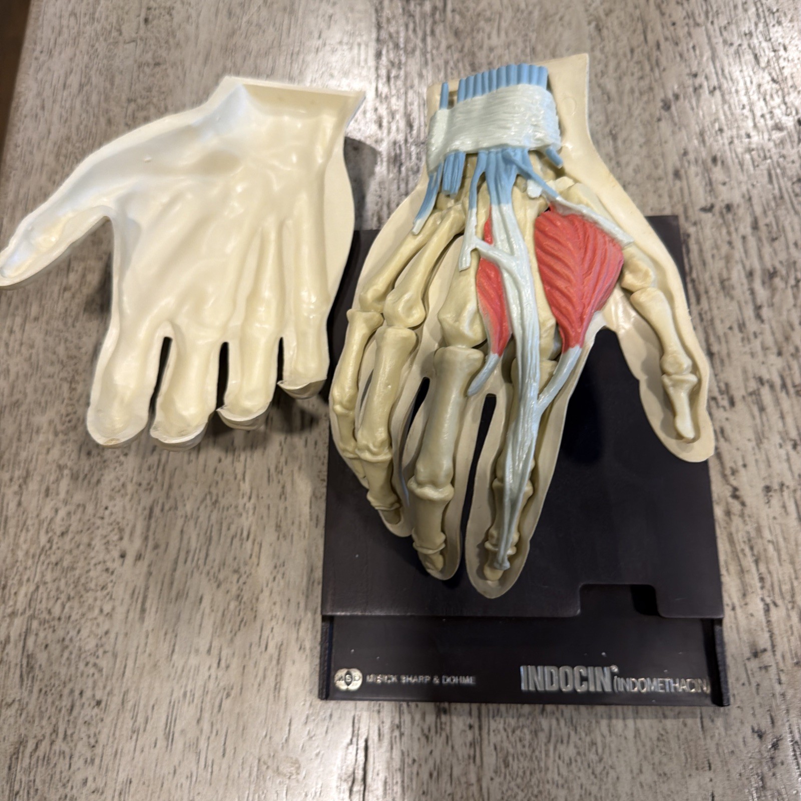 Vintage 1967 Human Hand Anatomical Display Model Merck Indocin Pharmaceutical