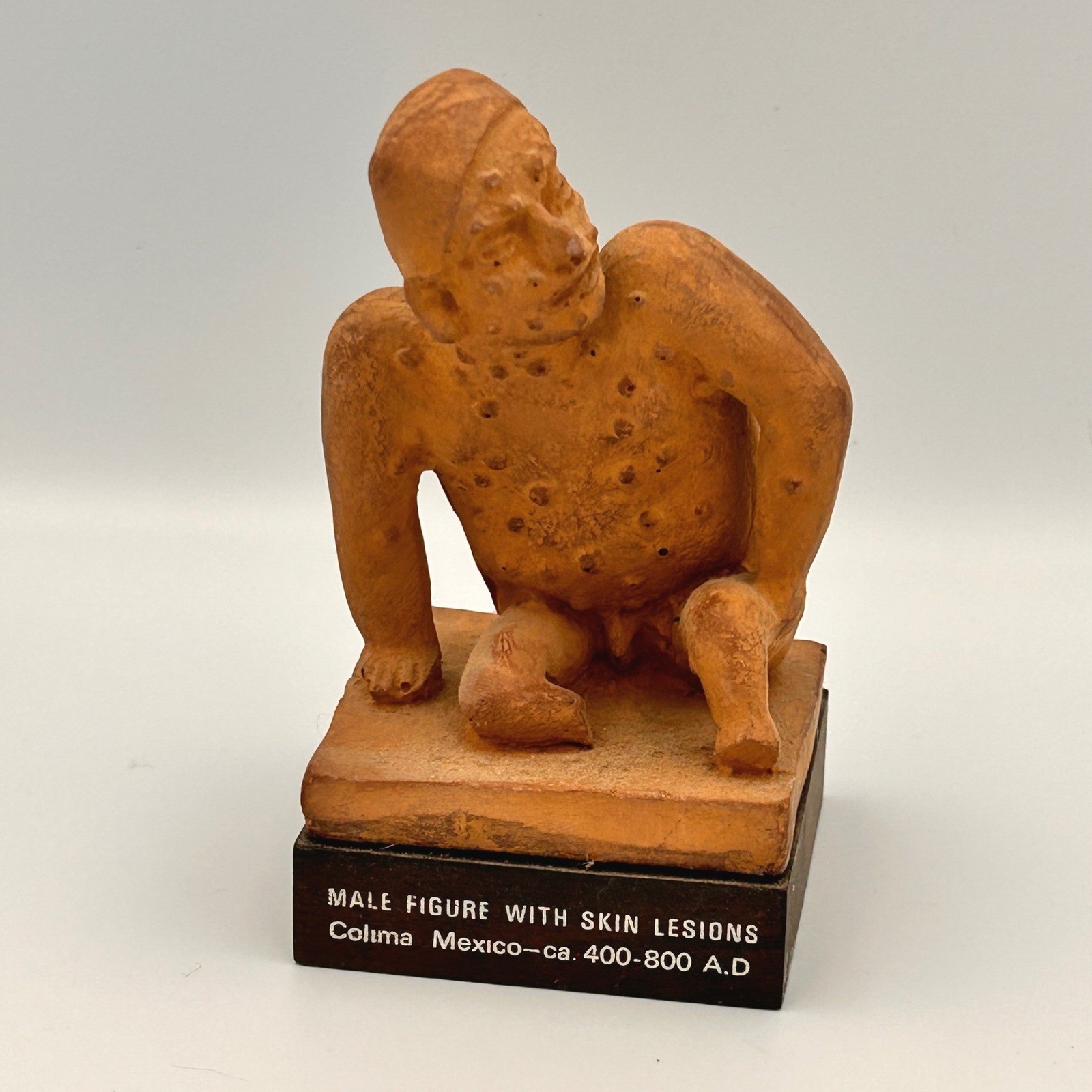 Vintage Schering Pharmaceutical Colima Mexico Male Skin Lesions Statue 1970s