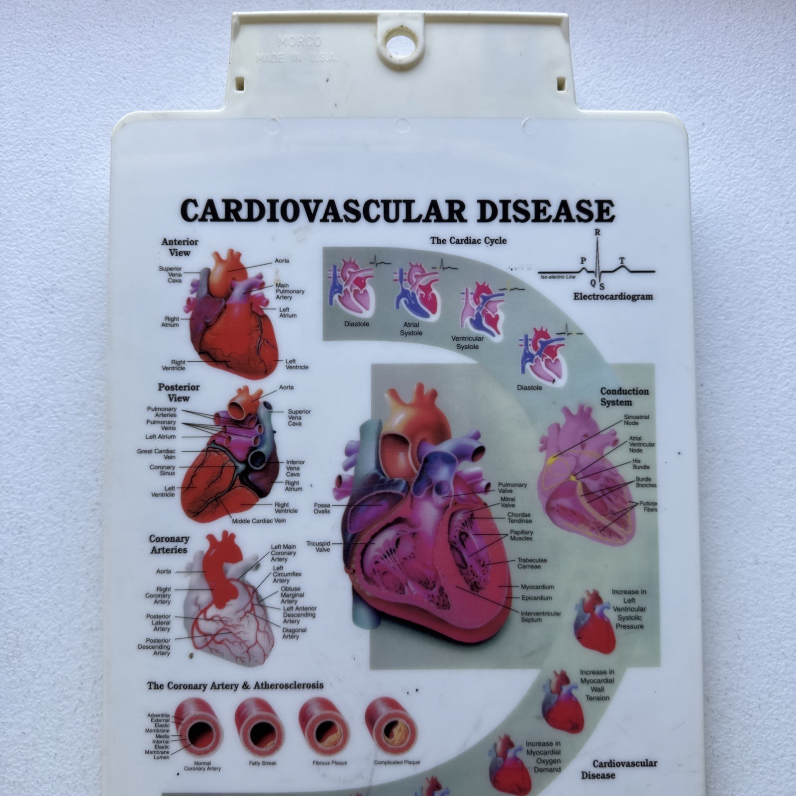 Vintage Plendil (Felodipine) Drug Advertising Clipboard