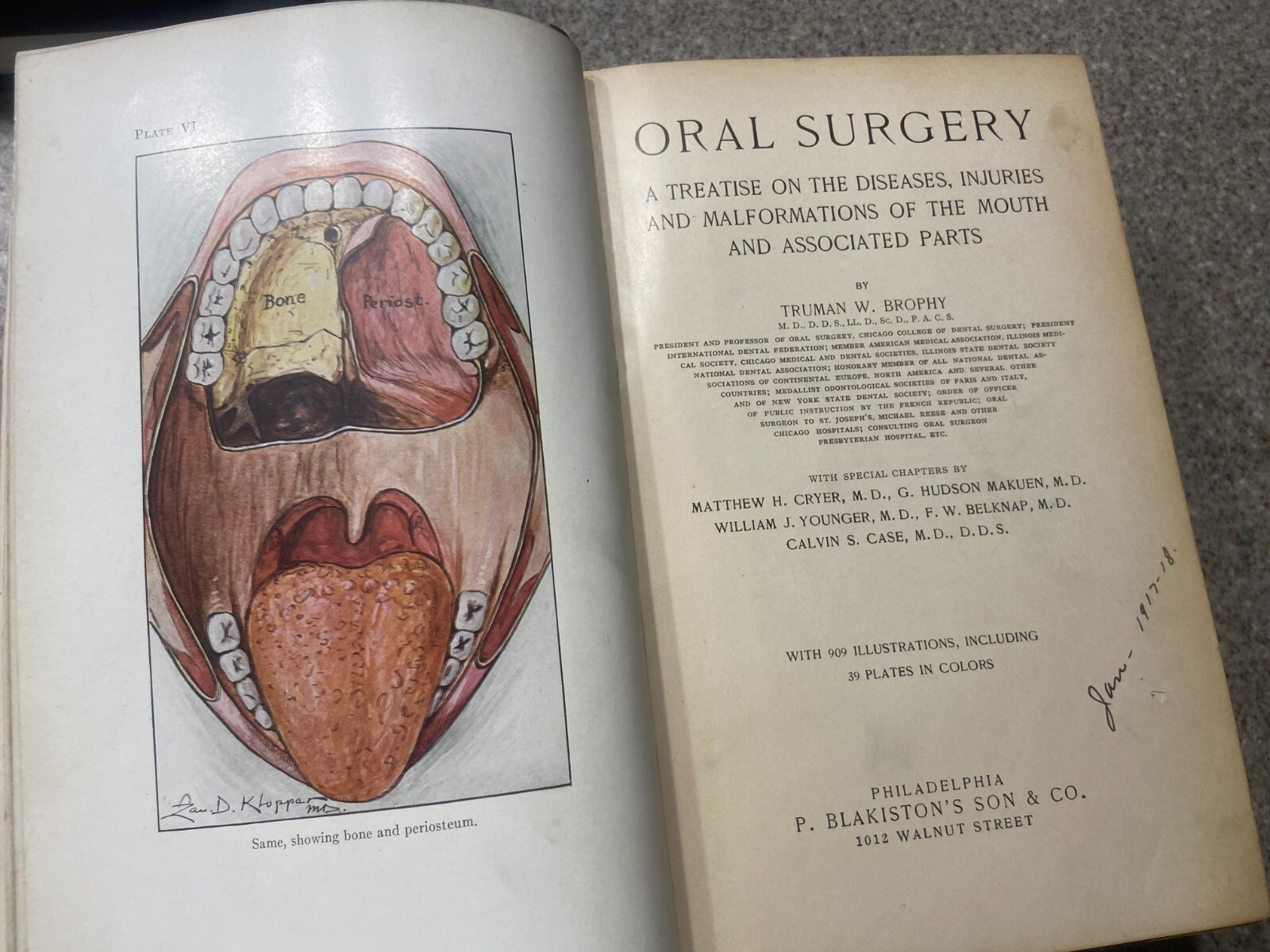 RARE Oral Surgery 1915 Illustrated Medical Dentistry Disease Truman W Brophy