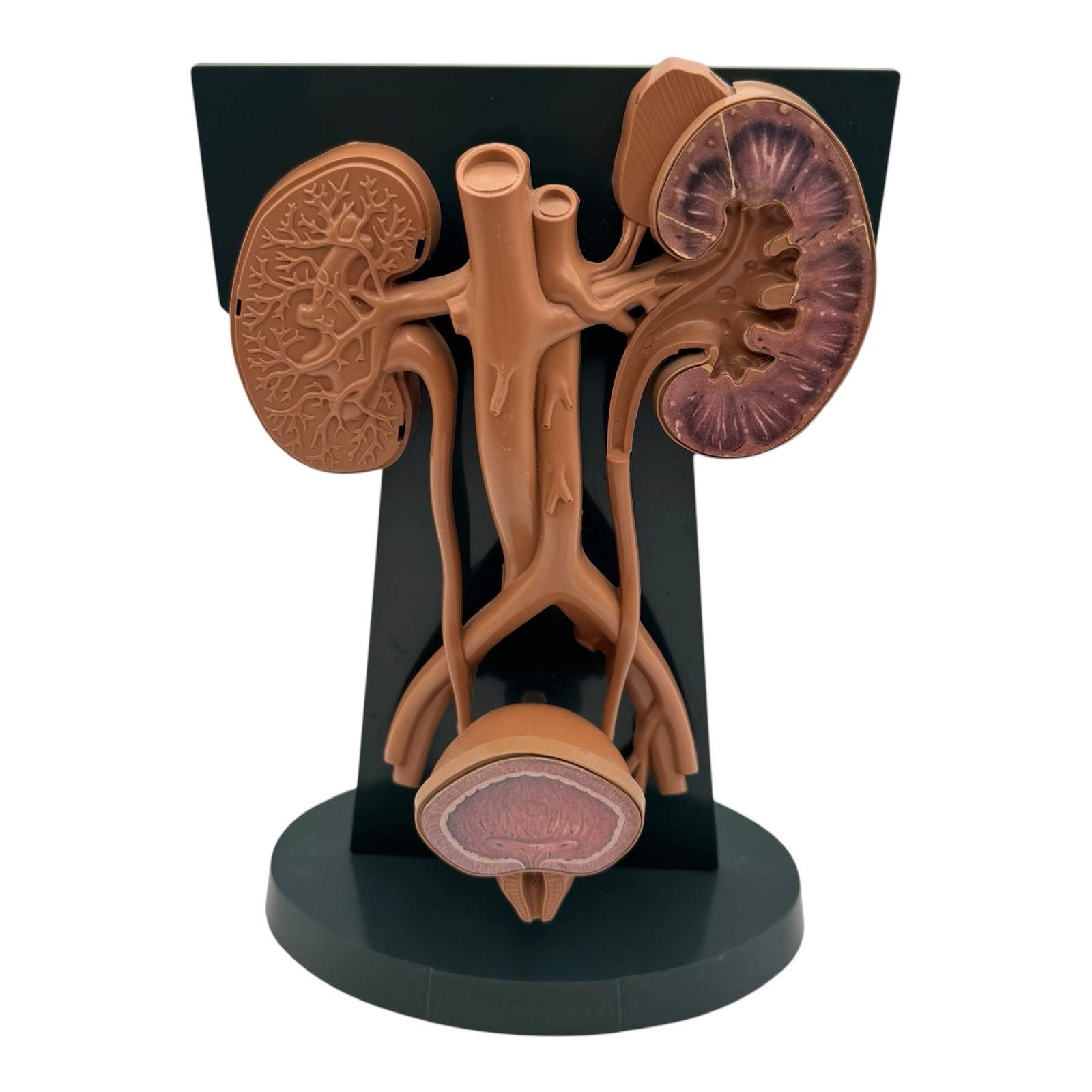 URINARY TRACT ANATOMY MODEL Medical DISPLAY Pharmaceutical RX Advertising Roche