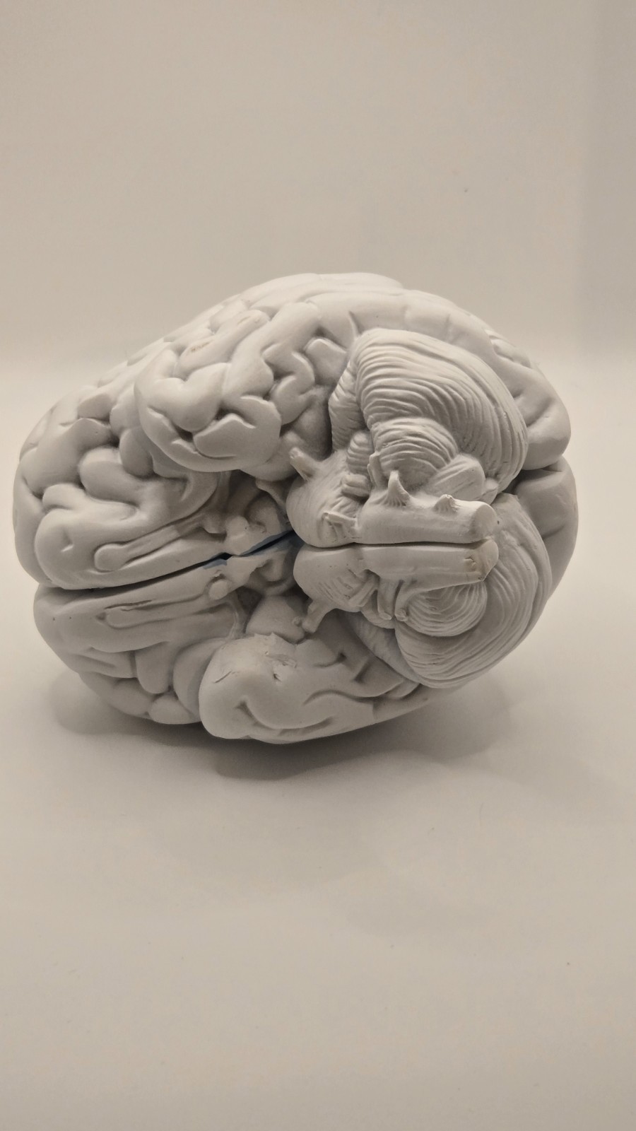 Alkermes Anatomical Brain Model Pharmaceutical Promo Desk Display