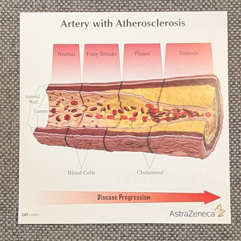 Drug Rep Promo AstraZeneca Cholesterol Artery Display Model w Educ. Flyers 2007