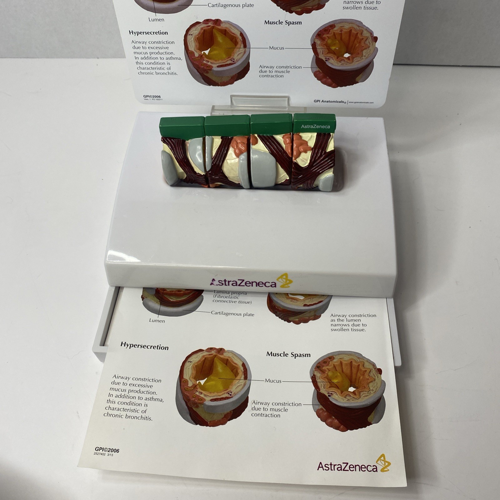 AstraZeneca Bronchus Airway Medical Anatomical Model Doctor Office Display