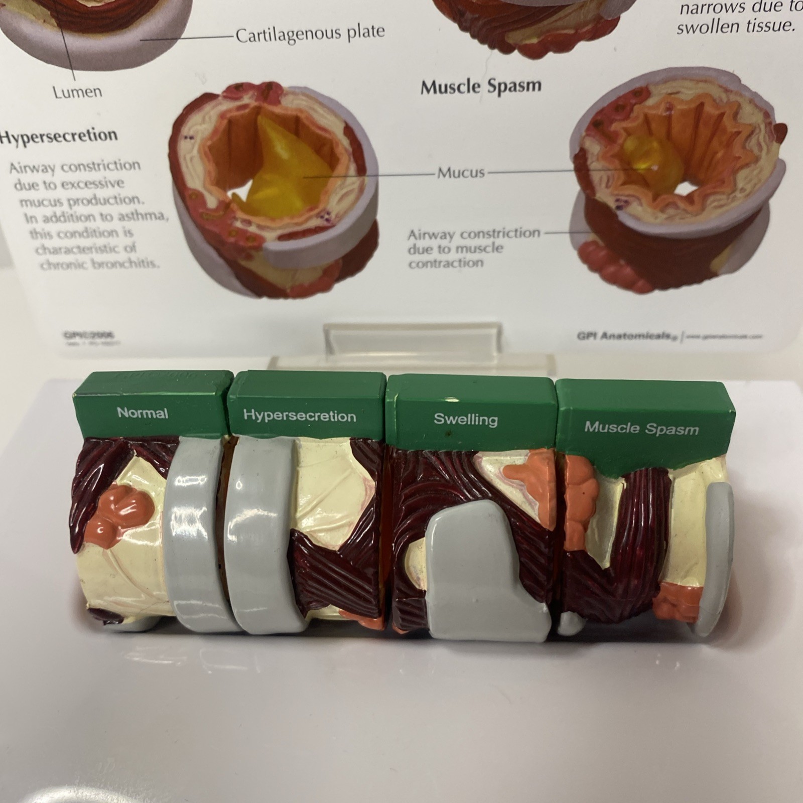 AstraZeneca Bronchus Airway Medical Anatomical Model Doctor Office Display