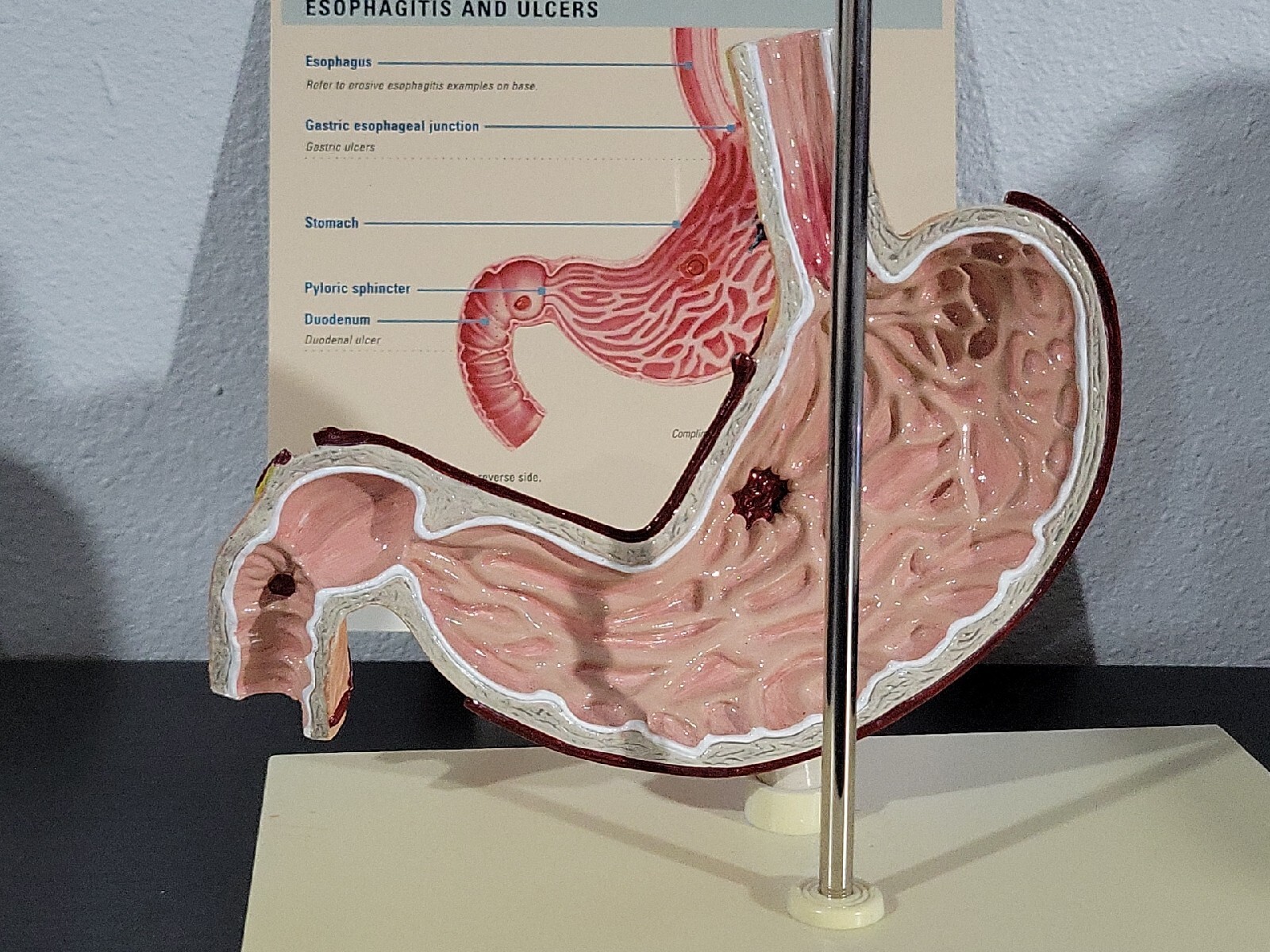 Vtg Prevacid & Zelnorm Doctor Pharmaceutical Display Esophagitis & Ulcers