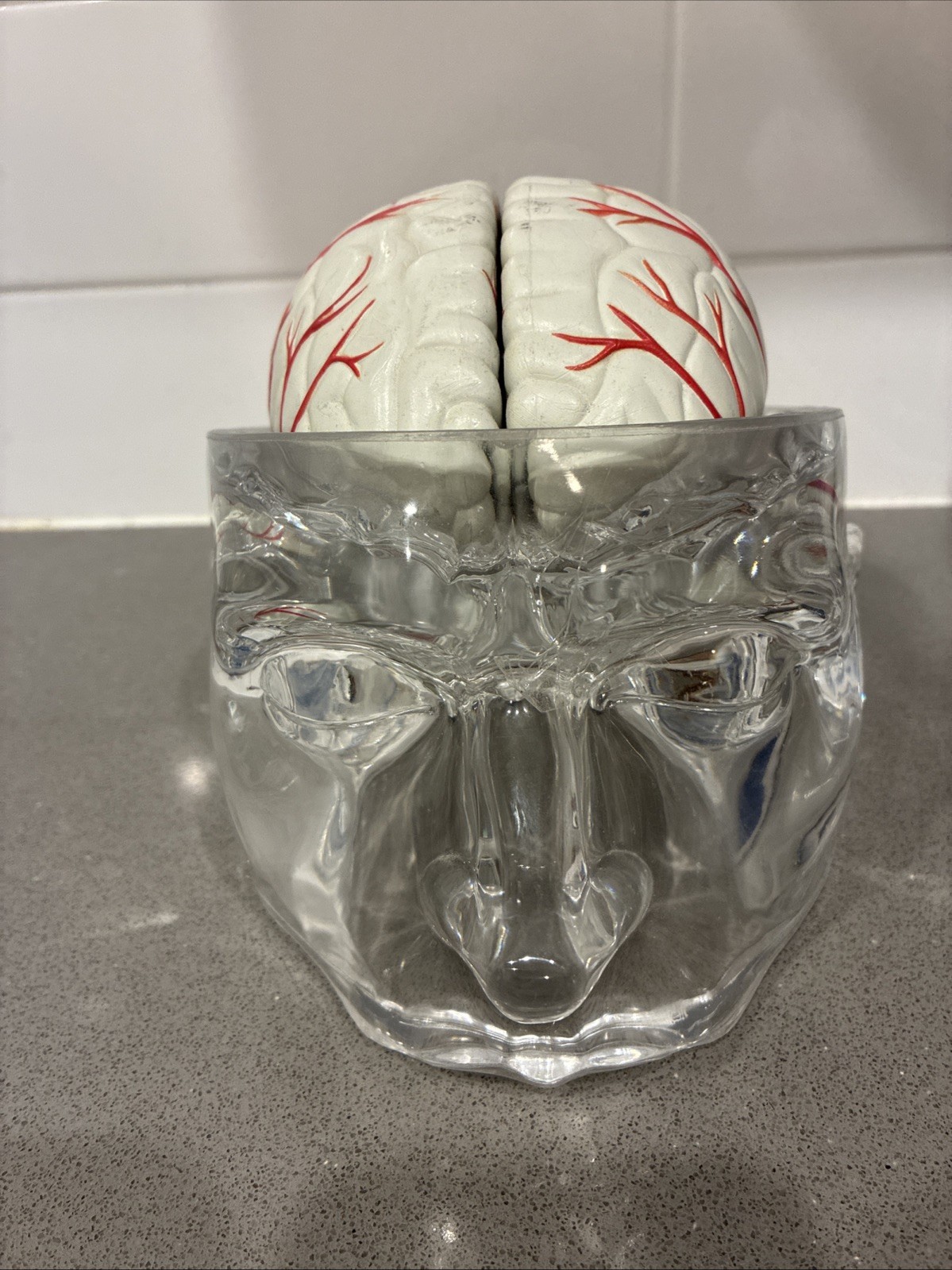 Seroquel Human Brain Anatomy Model w/ Clear Skull PharmaDesign Medical Display