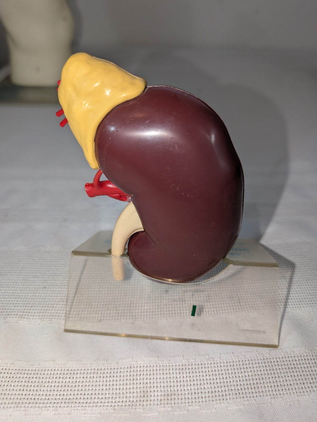 1960s Merck Pharmaceutical Advertising Model “Hydrodiuril Hydropres” Model