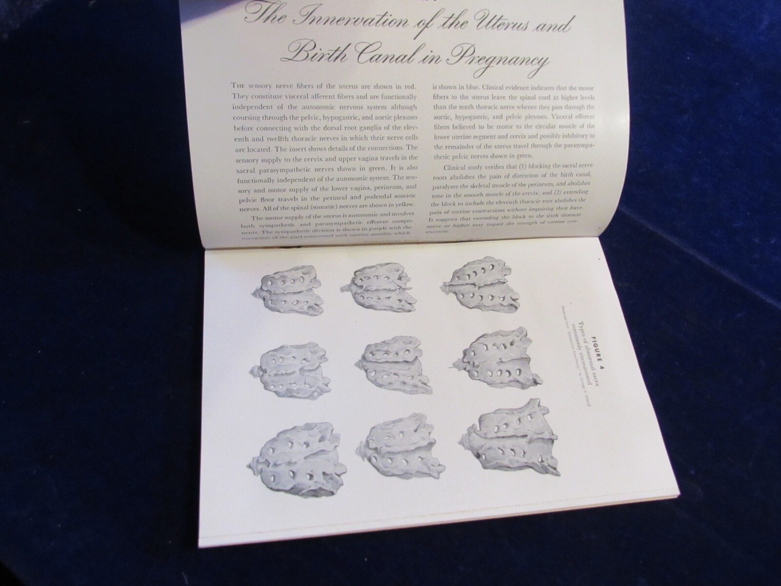 1950’s Medicine Drug Advertising Bklt Metycaine Eli Lily Color Illustrated B119