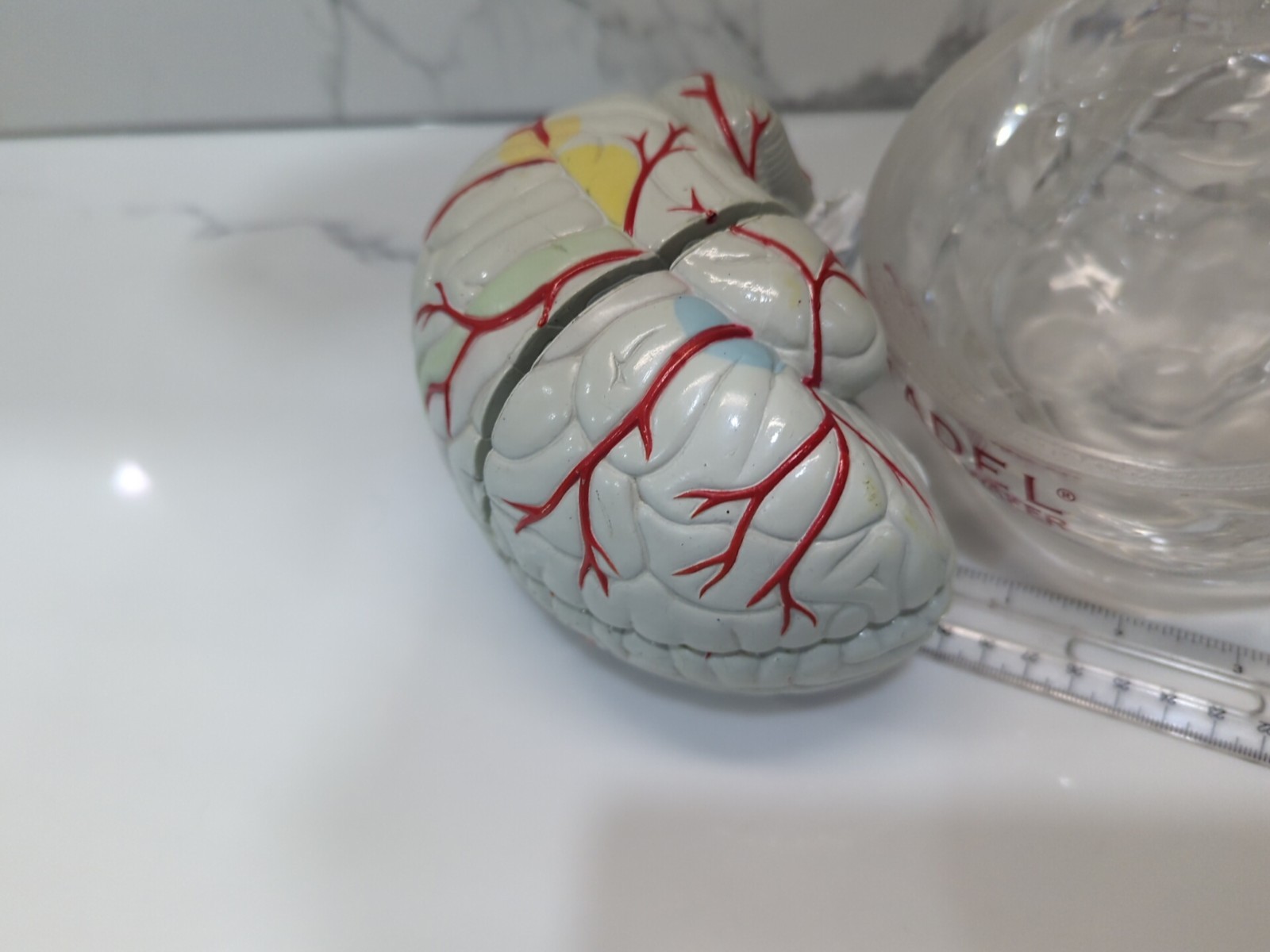 Gliadel Human Brain Anatomy Model w/ Clear Skull PharmaDesign Medical Display
