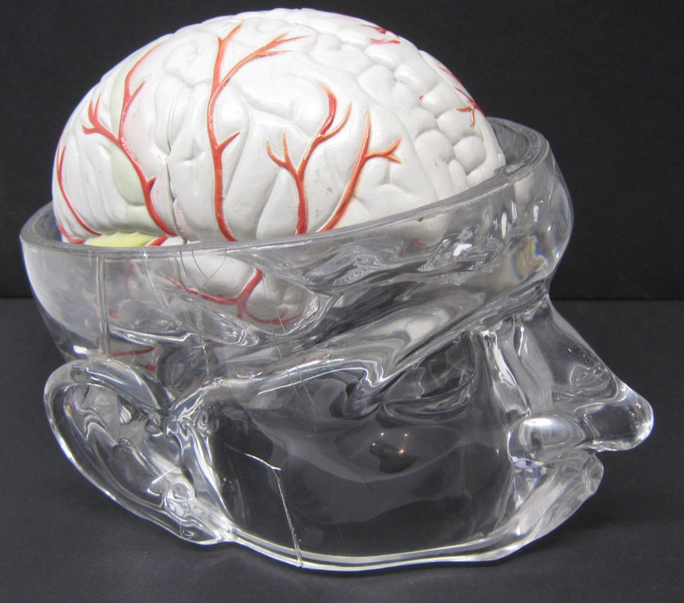 Seroquel Human Brain Anatomy Model w/ Clear Skull PharmaDesign Medical Display