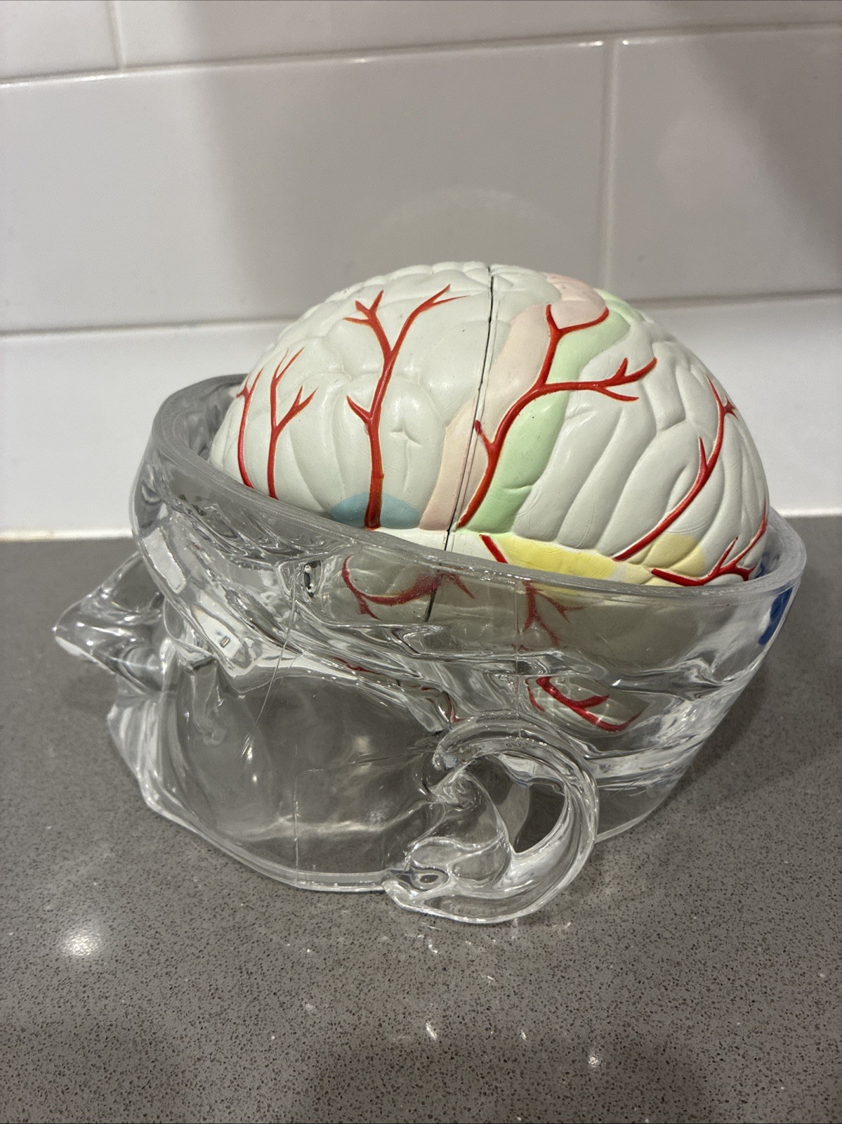 Seroquel Human Brain Anatomy Model w/ Clear Skull PharmaDesign Medical Display