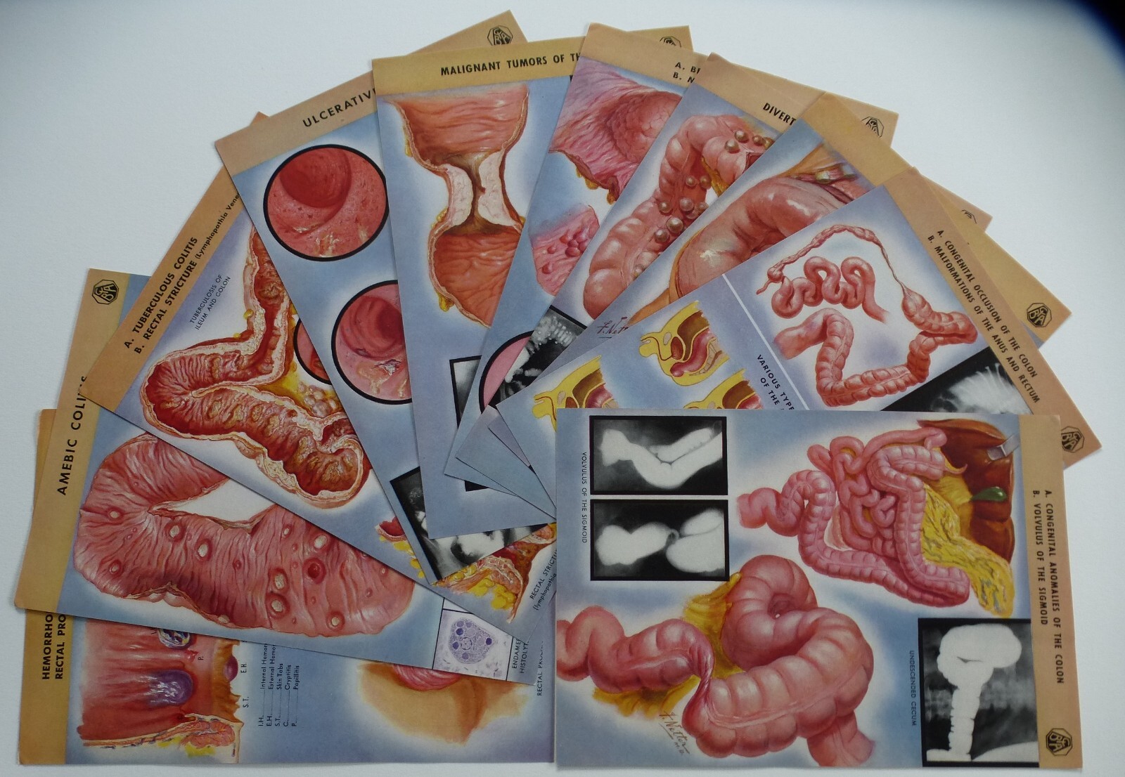18 Ciba Pharmaceutical Folders w/ Color Plates – Pathology Anatomy War Injuries