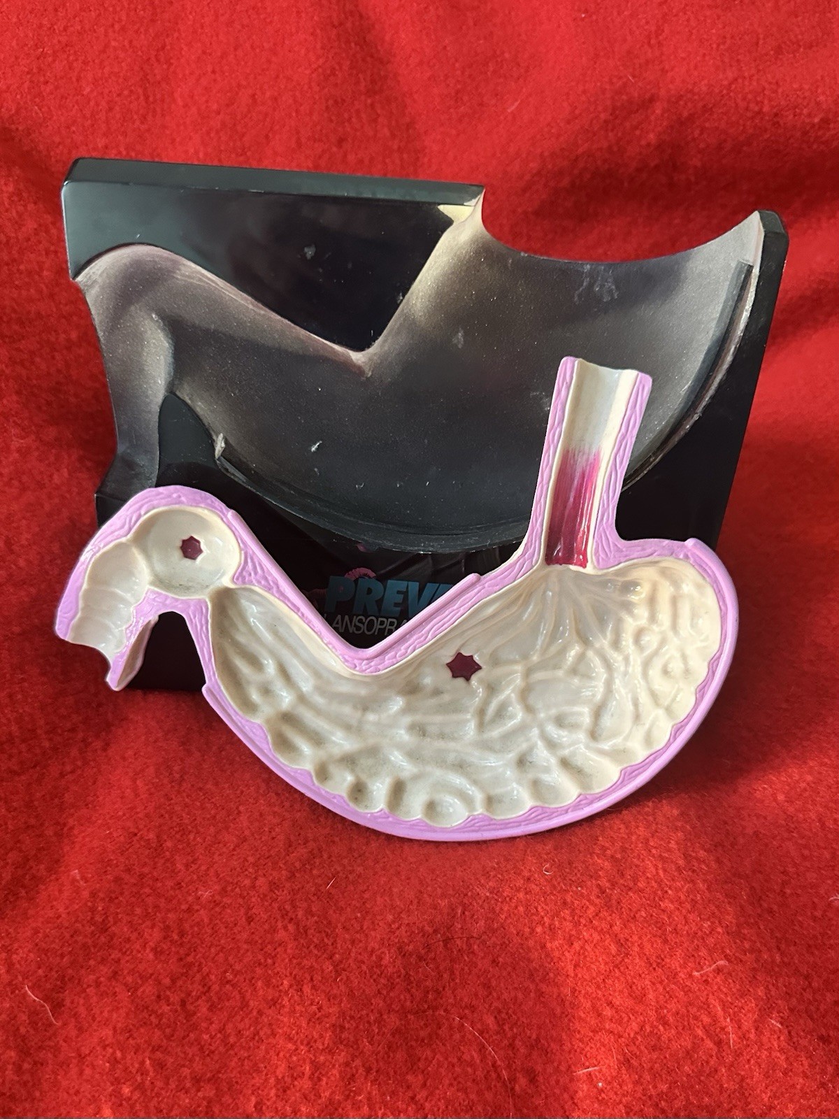 Ulcerated Stomach! Prevacid Drug Rep Demo Item, Lucite W/ Detachable Stomach VG