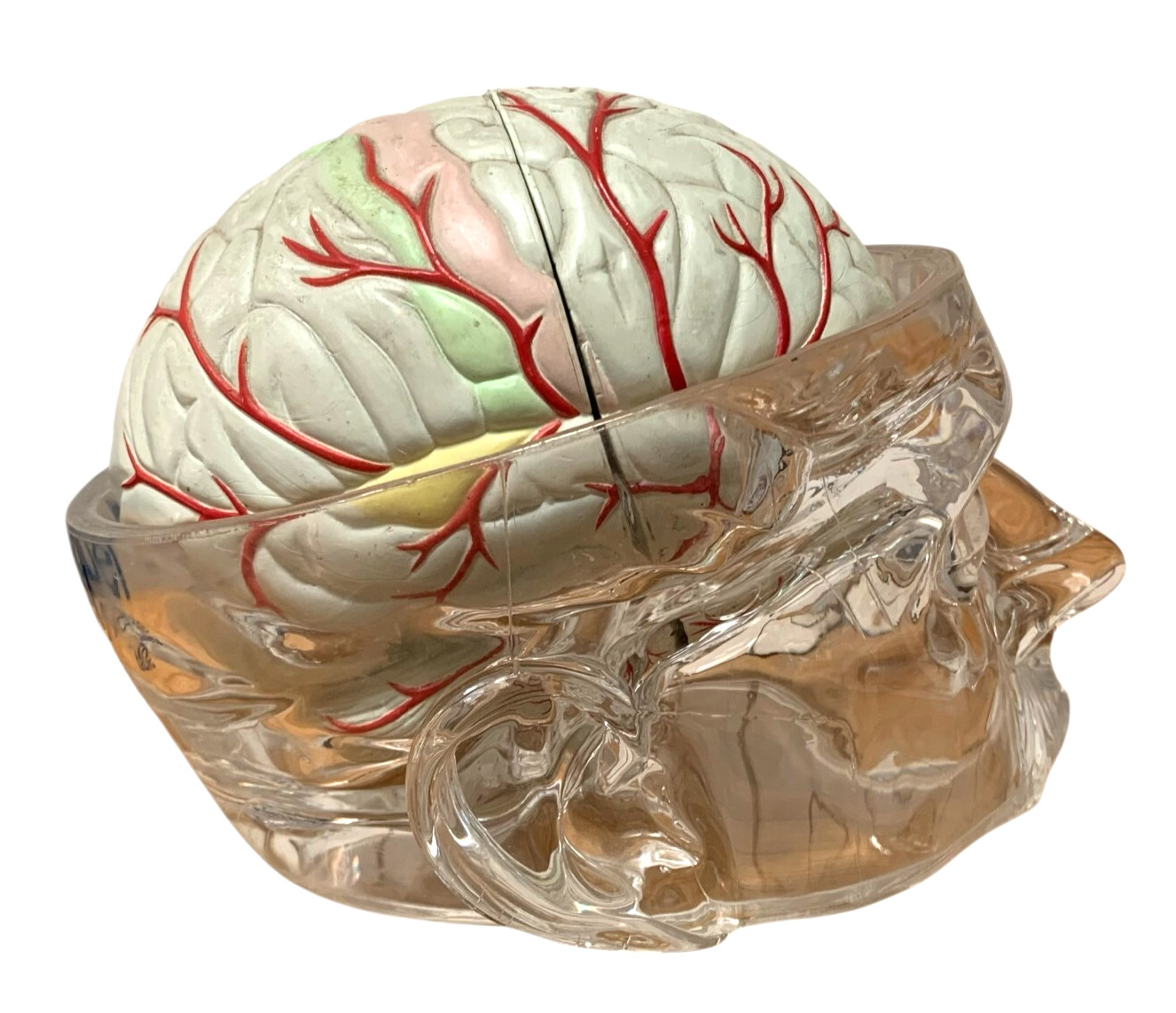 Vintage Seroquel Head Brain Anatomy Pharma Design Sales Display Removable Brain