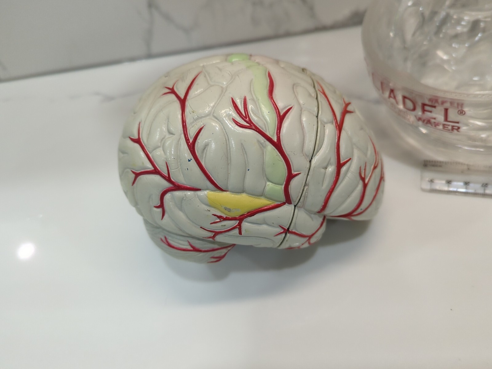 Gliadel Human Brain Anatomy Model w/ Clear Skull PharmaDesign Medical Display