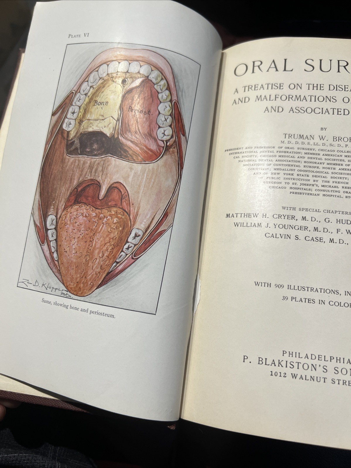 RARE Oral Surgery 1915 Illustrated Medical Dentistry Disease Truman W Brophy