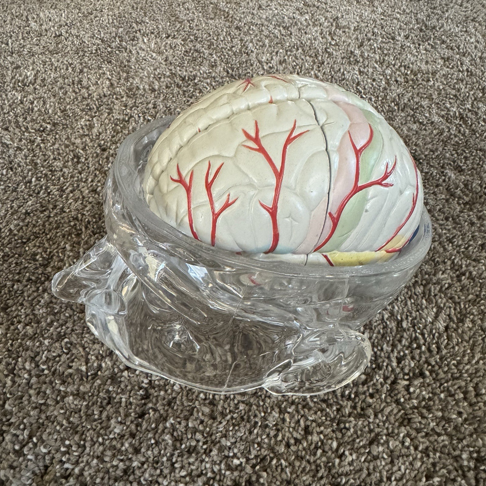 Lucite Head Skull Brain Model Medical Pharmaceutical Science Display – SEROQUEL