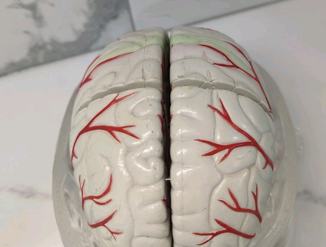 Gliadel Human Brain Anatomy Model w/ Clear Skull PharmaDesign Medical Display