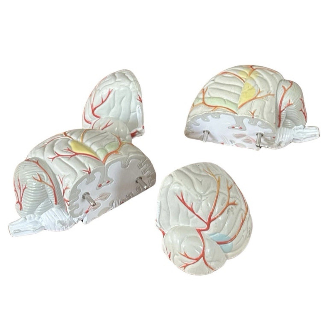 Lucite Head Skull Brain Model Medical Pharmaceutical Science Display – SEROQUEL