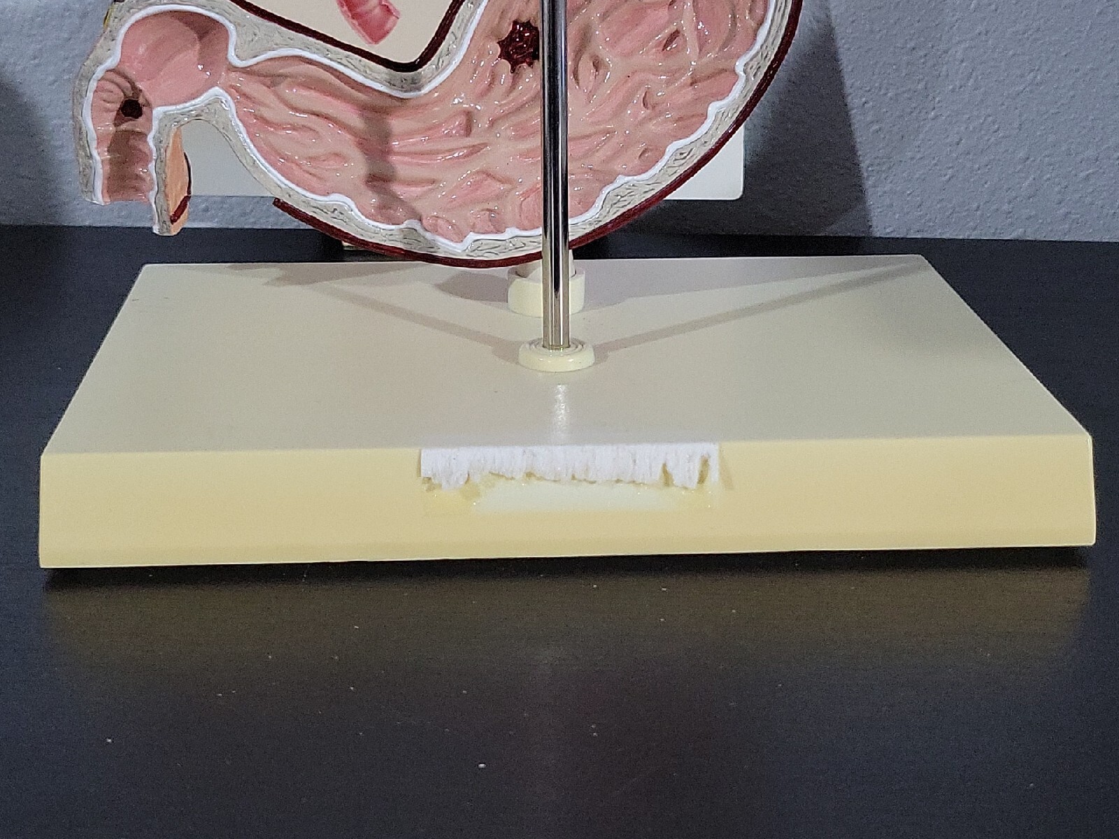 Vtg Prevacid & Zelnorm Doctor Pharmaceutical Display Esophagitis & Ulcers