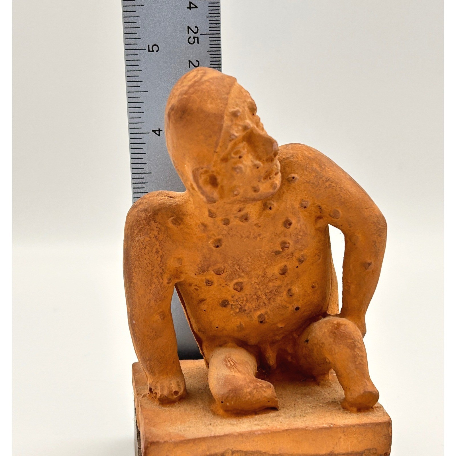 Vintage Schering Pharmaceutical Colima Mexico Male Skin Lesions Statue 1970s
