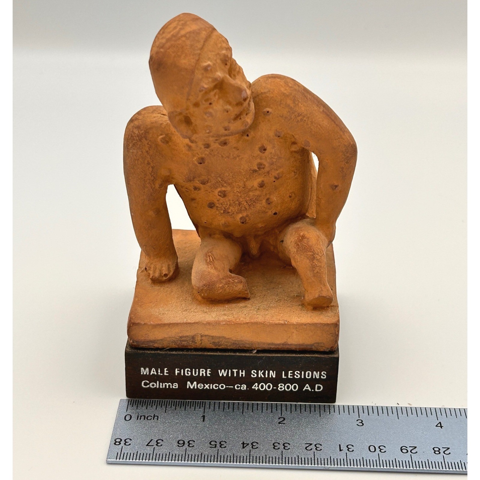 Vintage Schering Pharmaceutical Colima Mexico Male Skin Lesions Statue 1970s