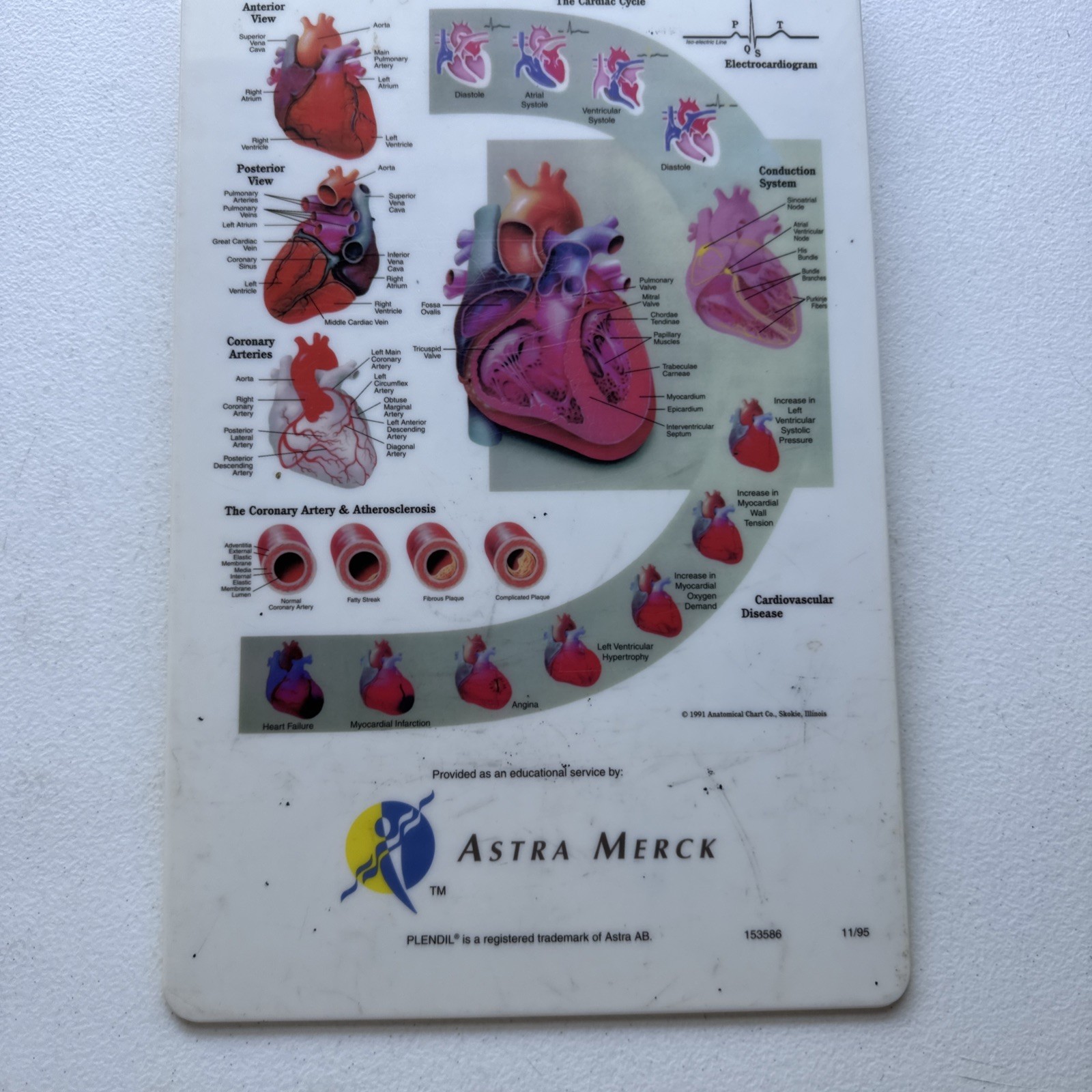 Vintage Plendil (Felodipine) Drug Advertising Clipboard