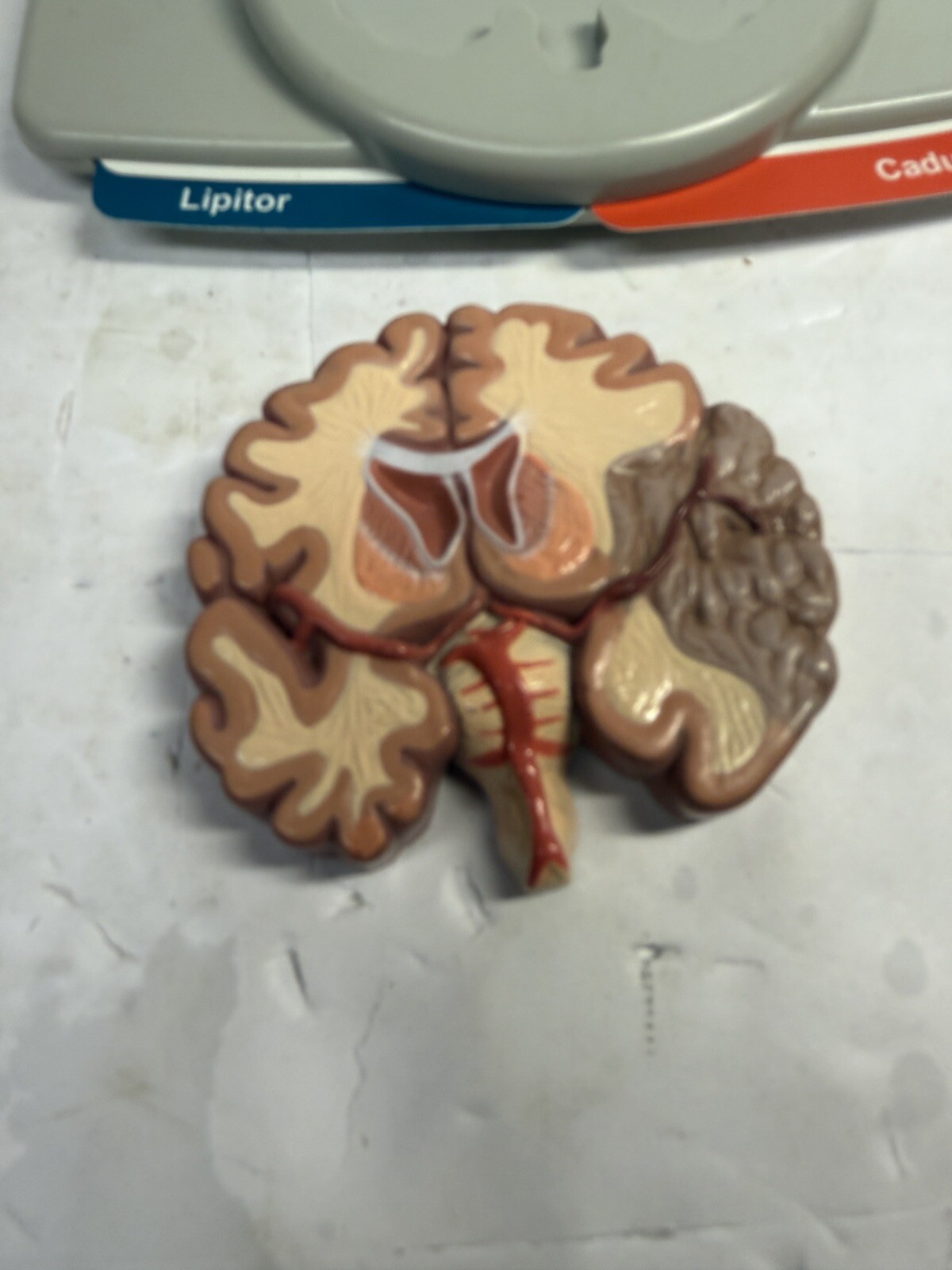 Vintage Drug Pharmaceutical Medical Rep Lipitor CAduet Brain Display