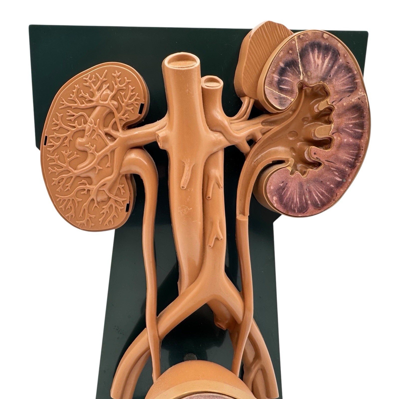 URINARY TRACT ANATOMY MODEL Medical DISPLAY Pharmaceutical RX Advertising Roche