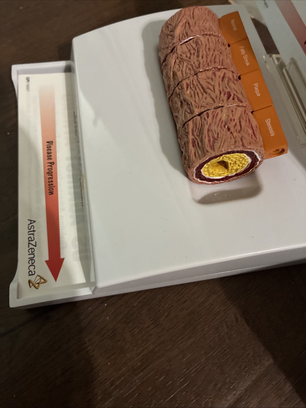 Drug Demonstration Promo AstraZeneca Cholesterol Artery Model W/Flyers 2007
