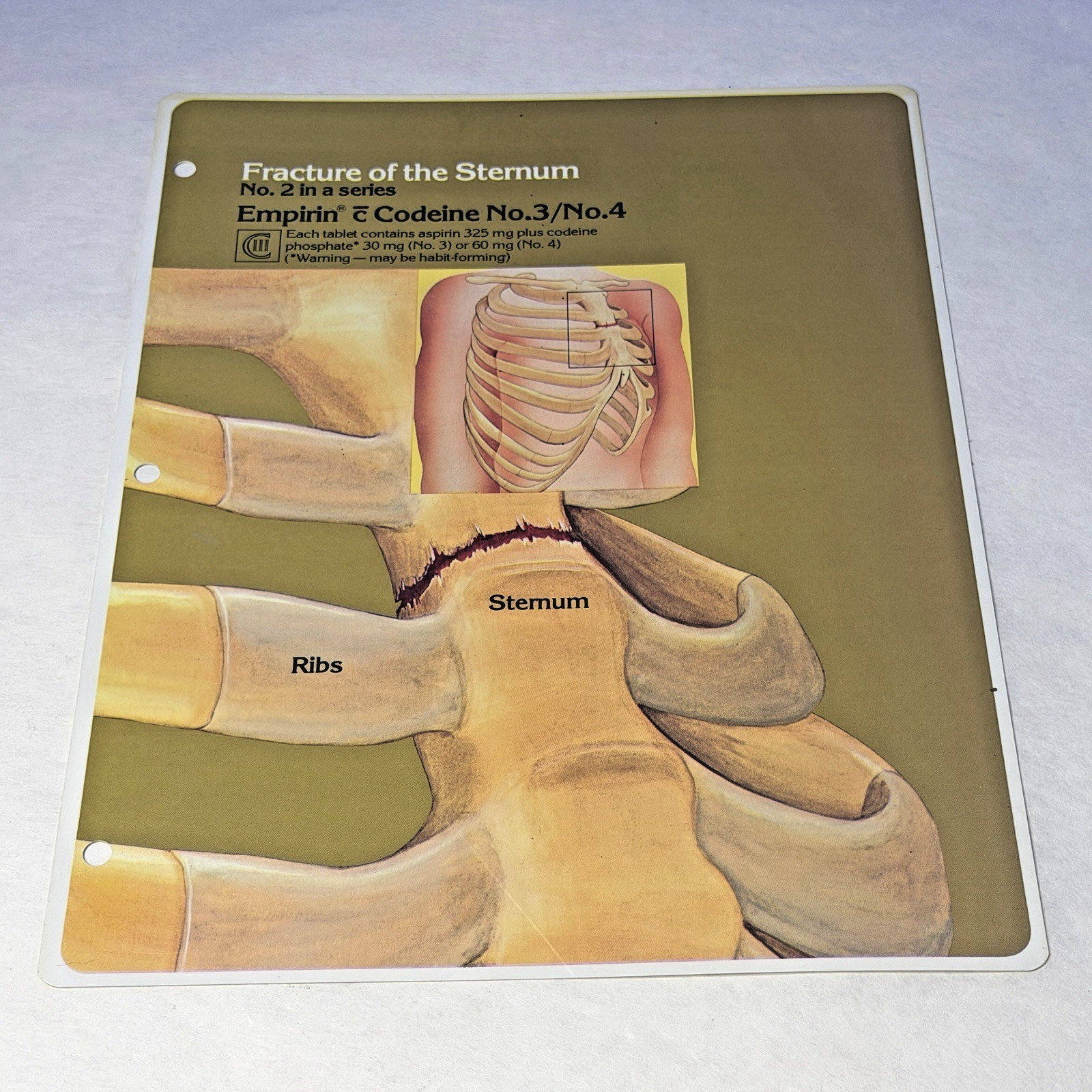 Codeine Medical Charts 5 Drug Rep Ad Promo Pharma Collectible Marketing 1980