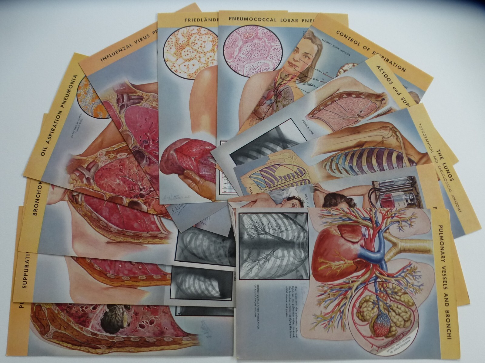18 Ciba Pharmaceutical Folders w/ Color Plates – Pathology Anatomy War Injuries