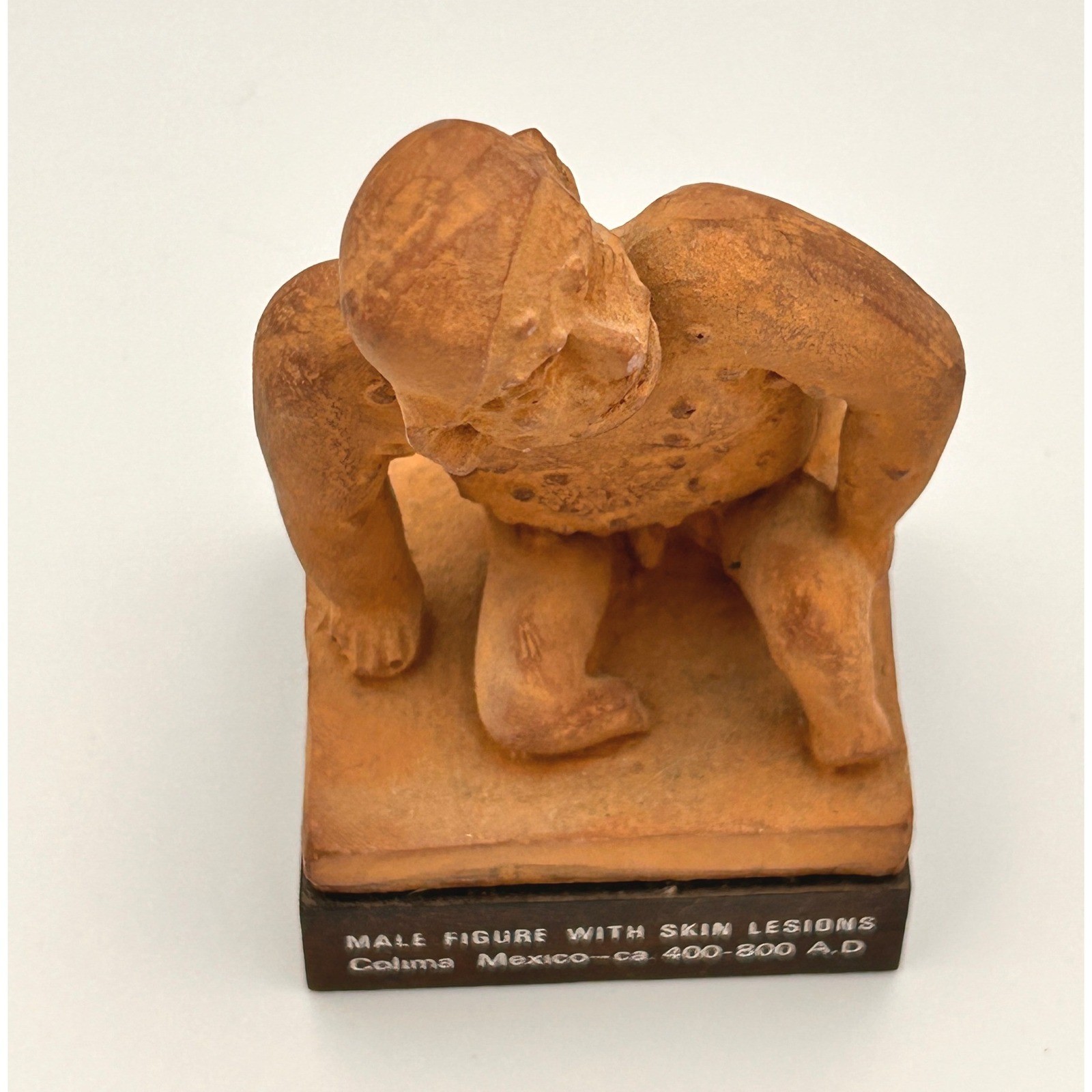 Vintage Schering Pharmaceutical Colima Mexico Male Skin Lesions Statue 1970s