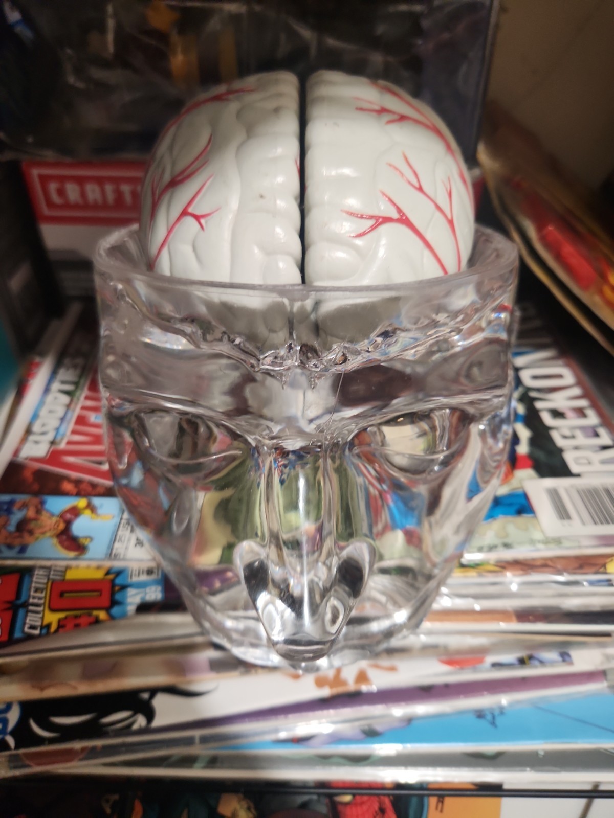 Seroquel Human Brain Anatomy Model w/ Clear Skull PharmaDesign Medical Display