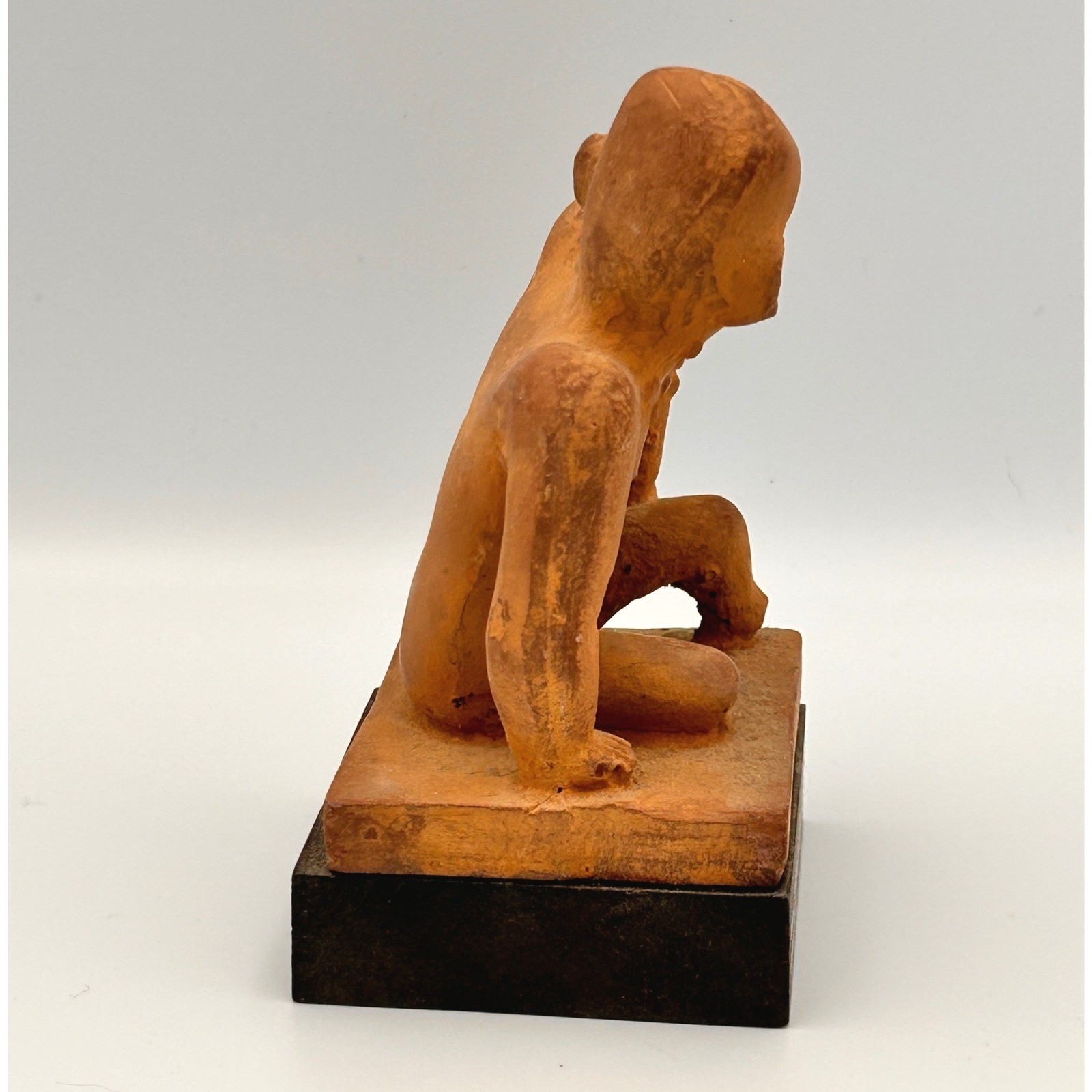 Vintage Schering Pharmaceutical Colima Mexico Male Skin Lesions Statue 1970s