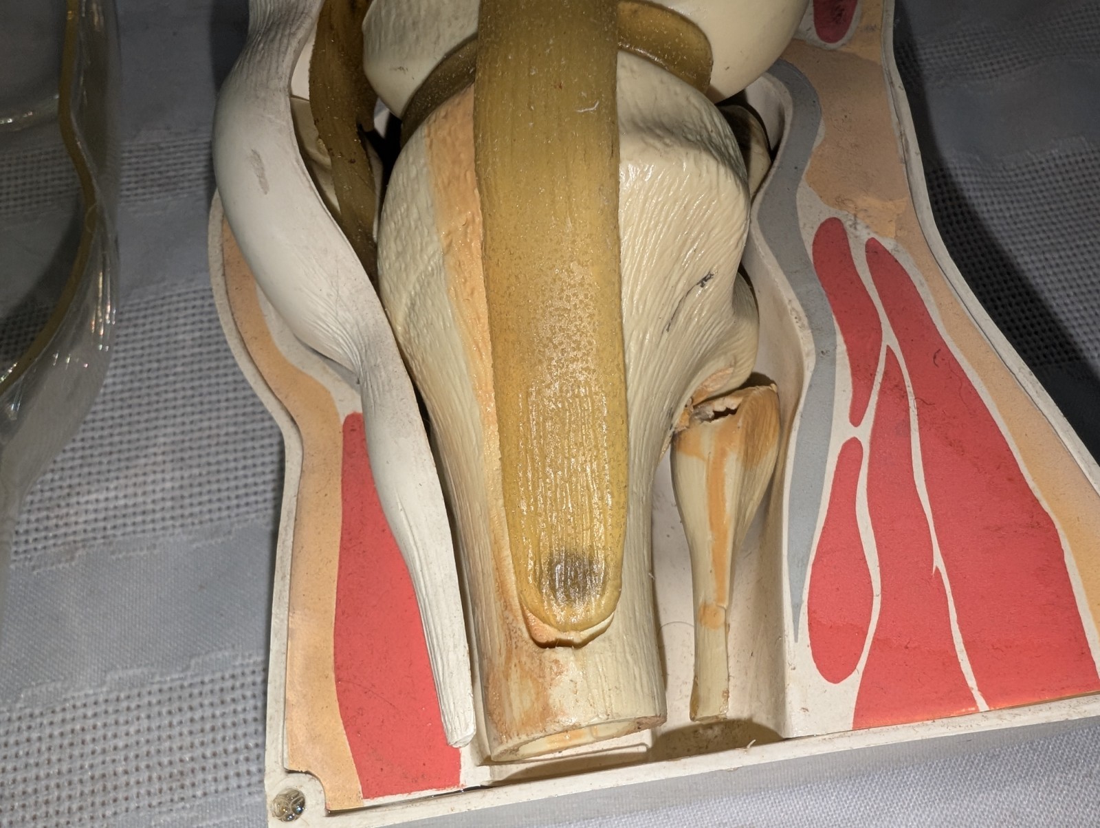1960s Merck Pharmaceutical Advertising Model “Decadron” Knee Model