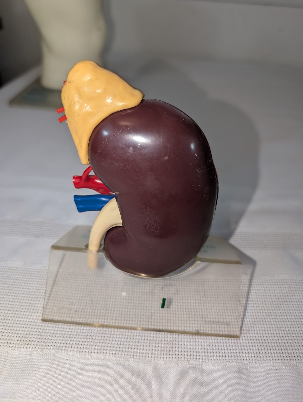 1960s Merck Pharmaceutical Advertising Model “Hydrodiuril Hydropres” Model