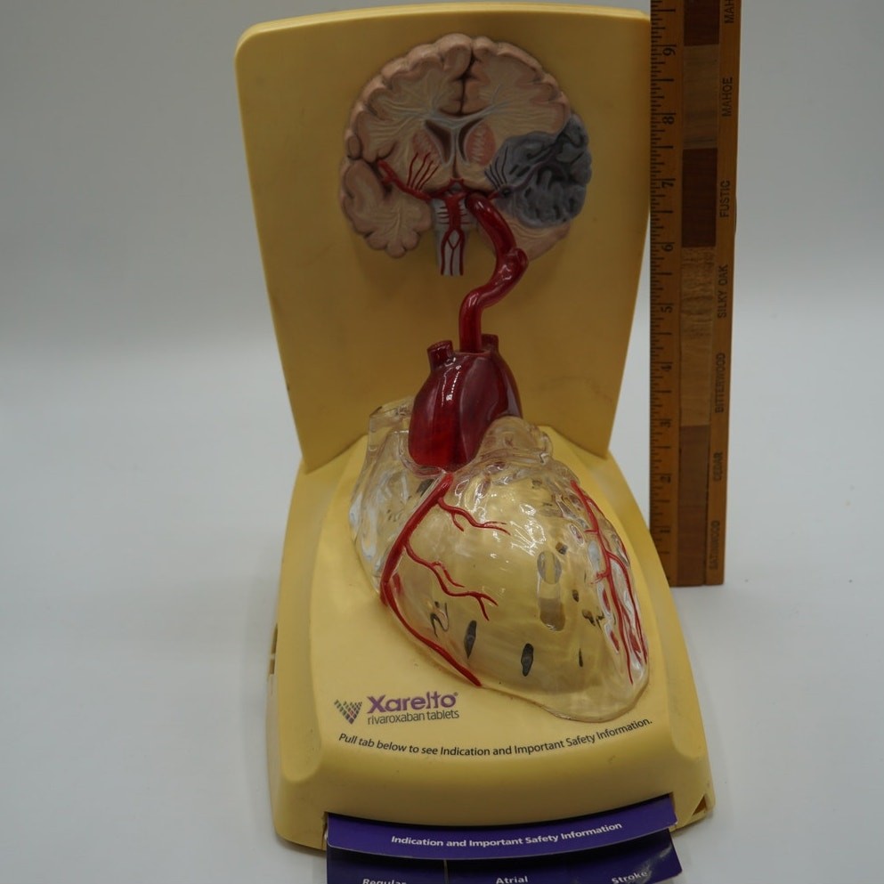Xarelto Pharmaceutical Advertising 3D Human Heart / Brain Display Model