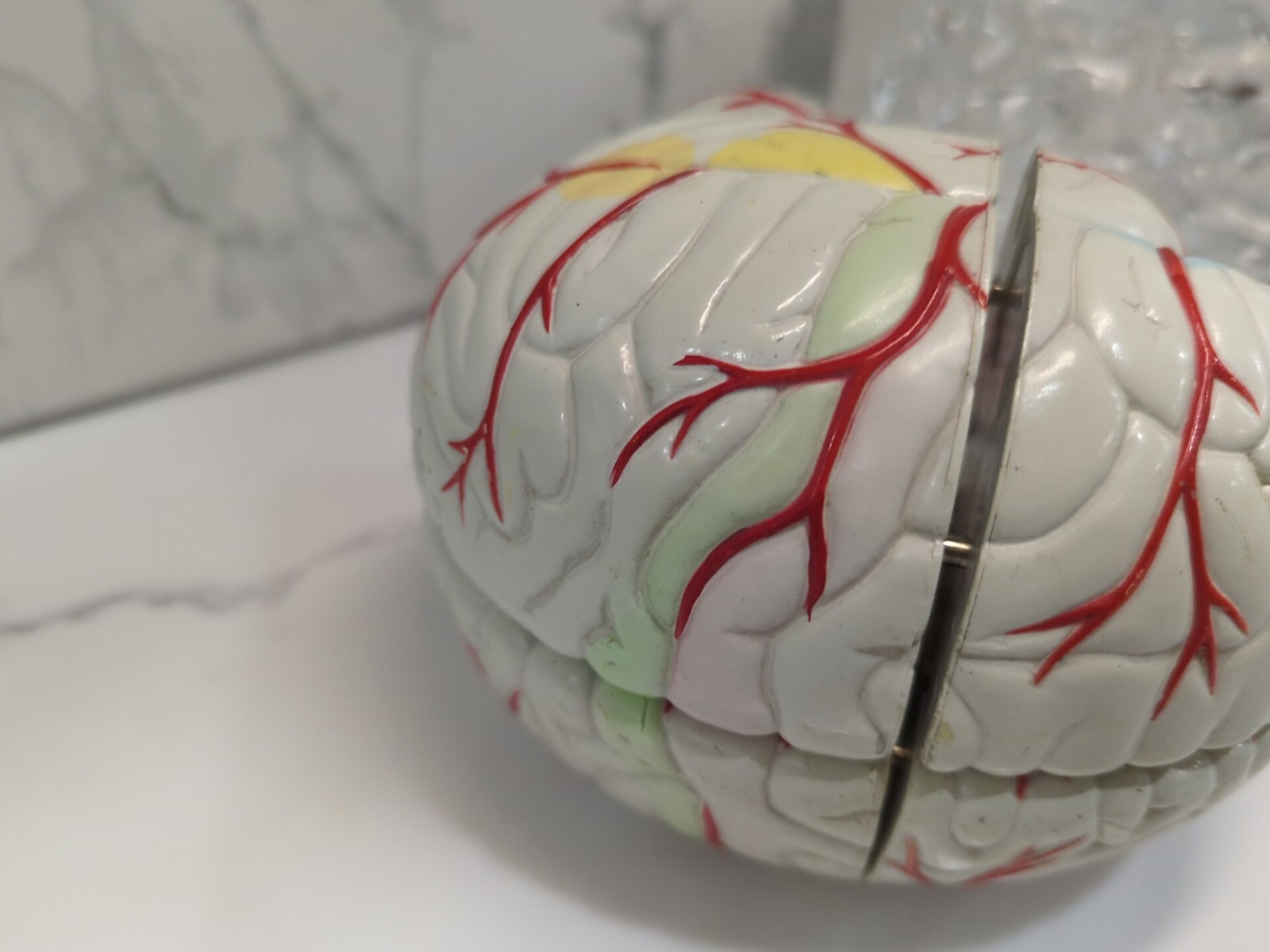 Gliadel Human Brain Anatomy Model w/ Clear Skull PharmaDesign Medical Display