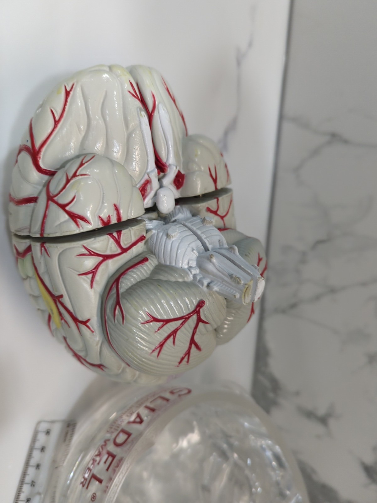 Gliadel Human Brain Anatomy Model w/ Clear Skull PharmaDesign Medical Display