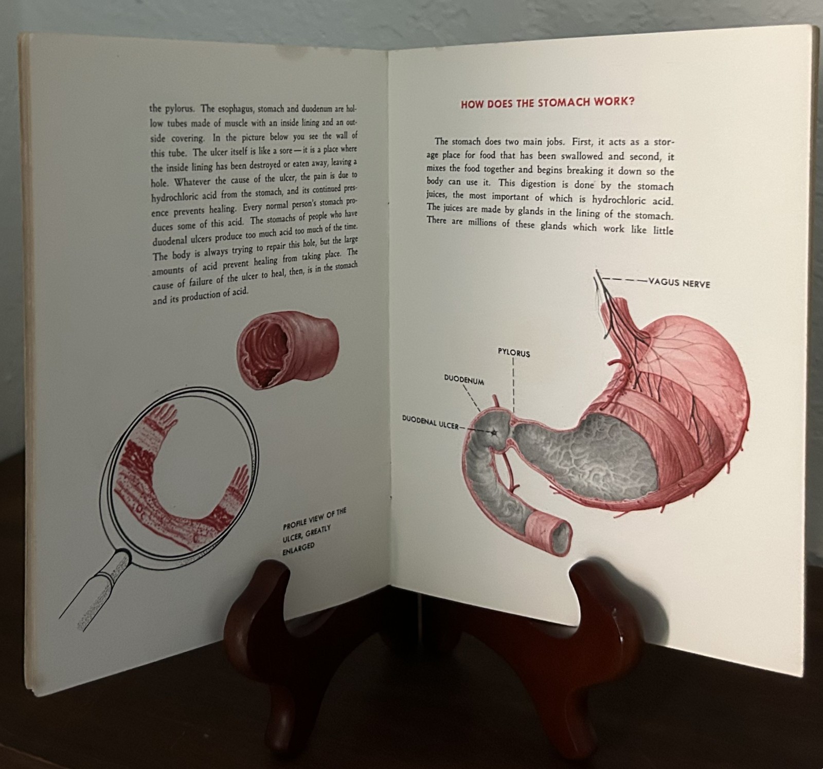 1954 Ulcer Patient Education Pamphlet Wyeth Amphojel Medical Ephemera Booklet
