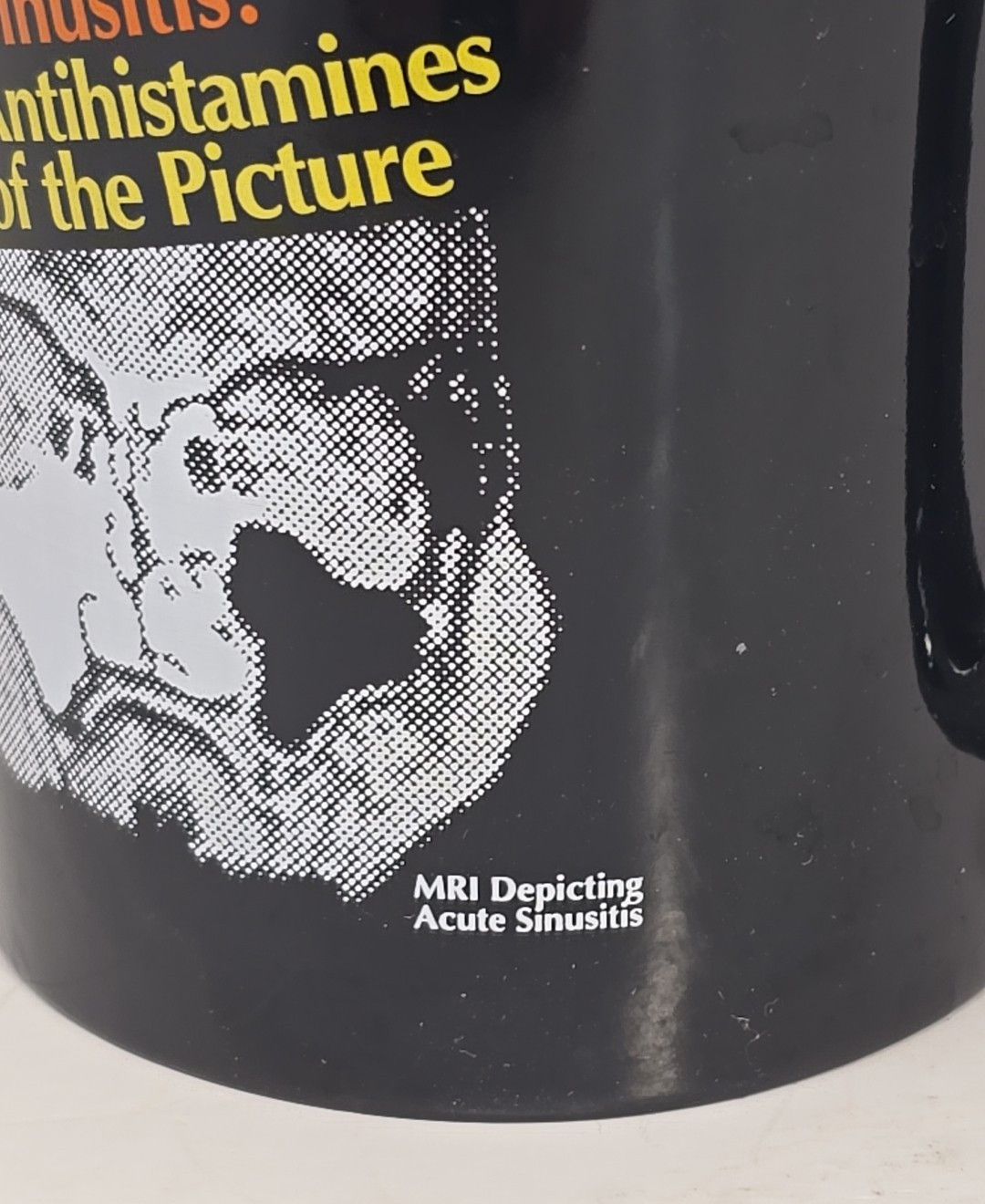 Entex LA PSE Black Coffee Mug Sinusitis MRI Image Pharmaceutical Drug Rep U237