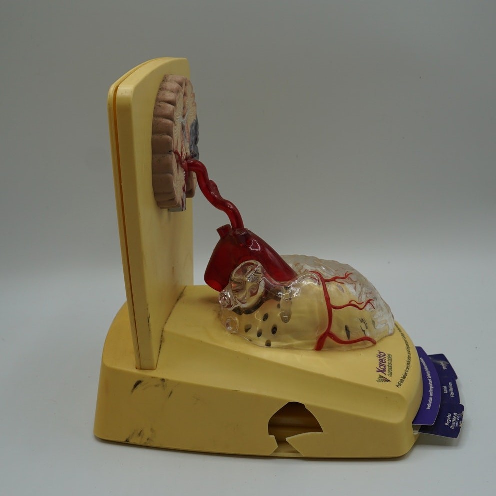 Xarelto Pharmaceutical Advertising 3D Human Heart / Brain Display Model